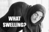 what swelling.jpg