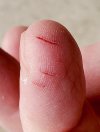 finger.jpg