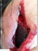 grinder accident.JPG