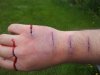 cut hand.jpg